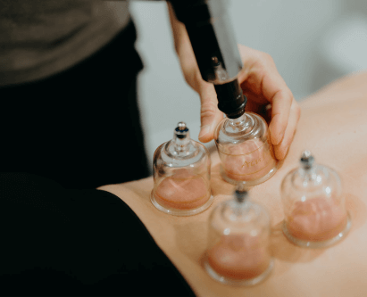 Myofascial Cupping