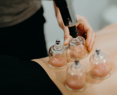 Myofascial Cupping
